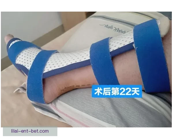 穆迪缺席10场后终于回归 科尔确认将于对阵独行侠时登场